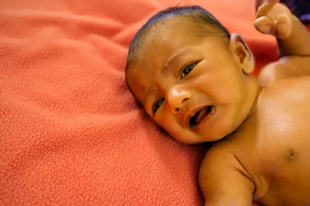 bayi kuning